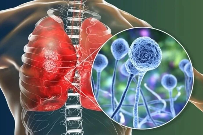 Die WHO schlägt Alarm wegen einer neuen globalen Bedrohung für die Gesundheit der Menschen